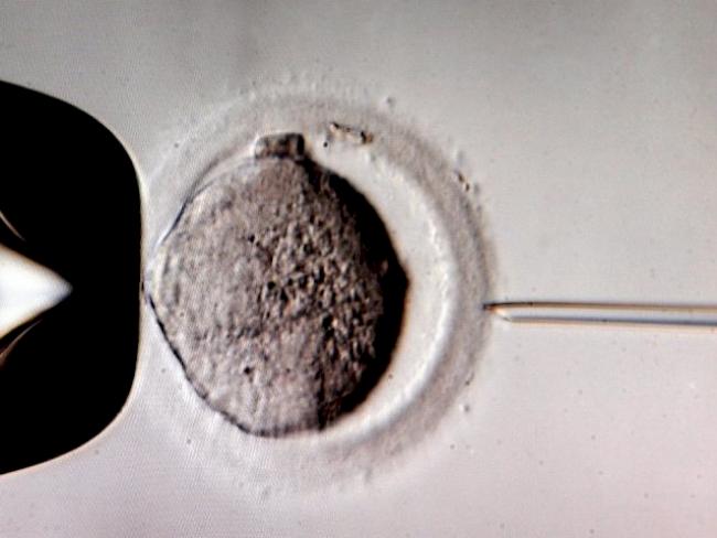 Mikroskop-Aufnahme einer In-vitro-Befruchtung (Symbolbild)