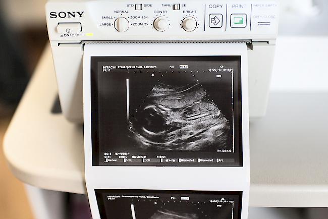 Ultraschall-Bild. Das Spital Visp verzeichnet steigende Geburtenzahlen (Symbolbild).