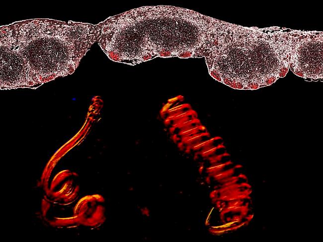 Eine von einem Darmwurm infizierte Maus produziert mehr Immunzellen.