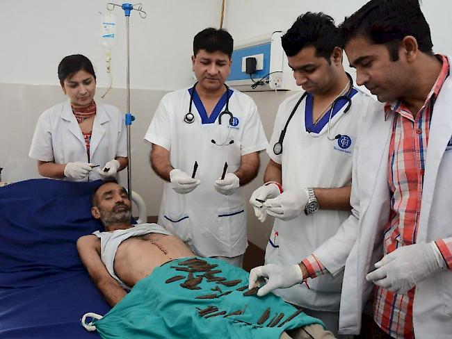 Ein indischer Polizist hat innert zwei Monaten 40 Messer geschluckt. Nach einer fünfstündigen Operation konnten ihn die Ärzte von der Masse im Magen befreien.