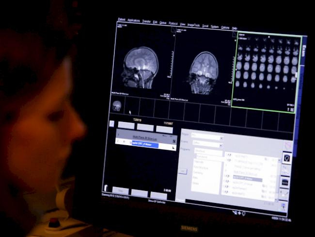 Messungen von Hirnaktivität im Rahmen von Autismus-Studie (Archiv)