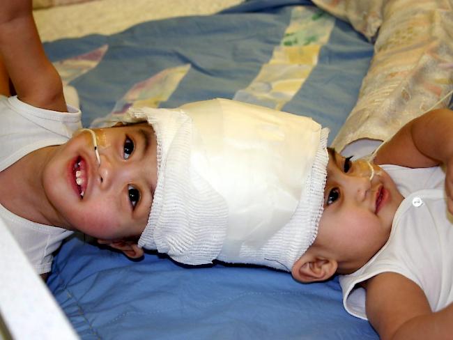 Gleiches Spital, andere Kinder: Bereits 2003 trennten Ärzte an der Klinik Montefiore in New York siamesische Zwillinge. (Archivbild)
