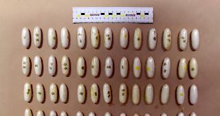 Nicht wenige. Die gefasste Frau hatte insgesamt 52 Fingerlinge im K&ouml;rper.