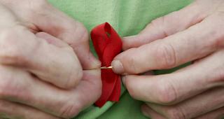 Die HIV-Heimtest sind gem&auml;ss EKSG breit validiert und technisch gut (Symbolbild).
