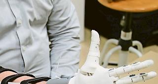 Digitale Revolution. Die Zukunft der Handprothesen ist robotergesteuert und 3D-gedruckt.Foto zvg