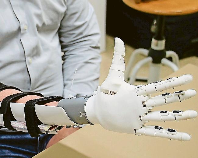 Digitale Revolution. Die Zukunft der Handprothesen ist robotergesteuert und 3D-gedruckt.Foto zvg