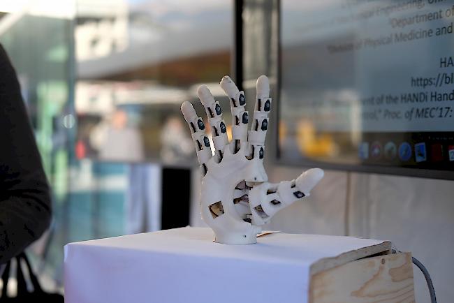 Die Handprothese ist 3D-gedruckt
