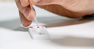 Kinderleicht. Innerhalb von 15 Minuten liefert der Selbsttest ein Resultat mit 99-prozentiger Sicherheit. Eine abschliessende Diagnose kann aber nur der Arzt liefern.Foto WB/Alain Amherd