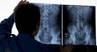 Die sichergestellten Drogen wurden entweder im Reisegep&auml;ck eingebaut, lose mitgef&uuml;hrt oder im K&ouml;rper versteckt. 