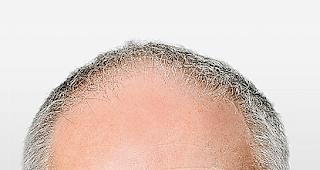 Szenen der Demenz. &laquo;Ich habe Hoffnung.&raquo; Andreas Monsch, Demenzforscher. Fotos Keystone/zvg